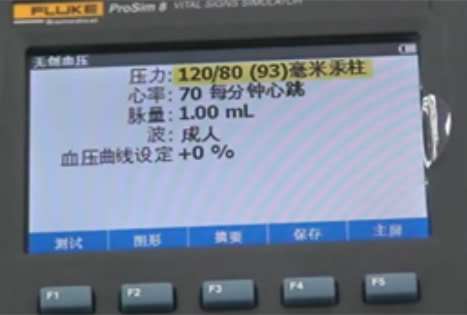 設(shè)置無創血壓(動(dòng)态)